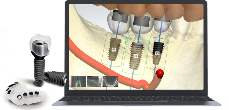 Slider image (5) Seoul Today Dental Clinic